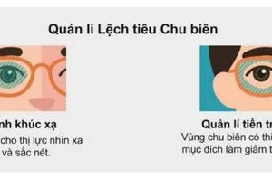 Tròng Kính Zeiss MyoVision Pro