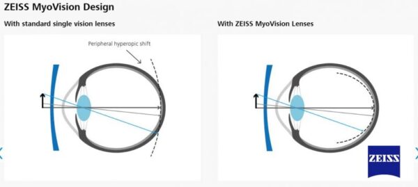 Tròng Kính Zeiss MyoVision Pro